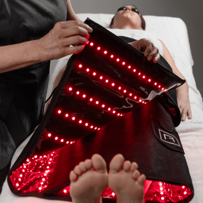 FHOS Manta LED Matte ohne Ausfallzeit